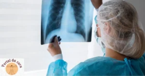 Sintomas da tuberculose