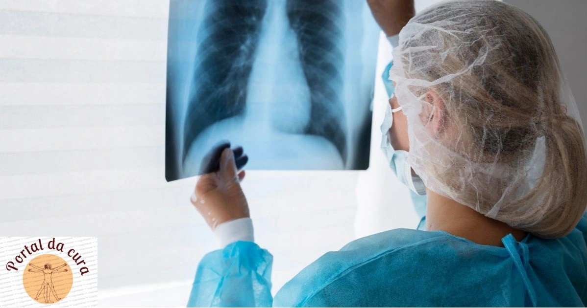 Sintomas da tuberculose